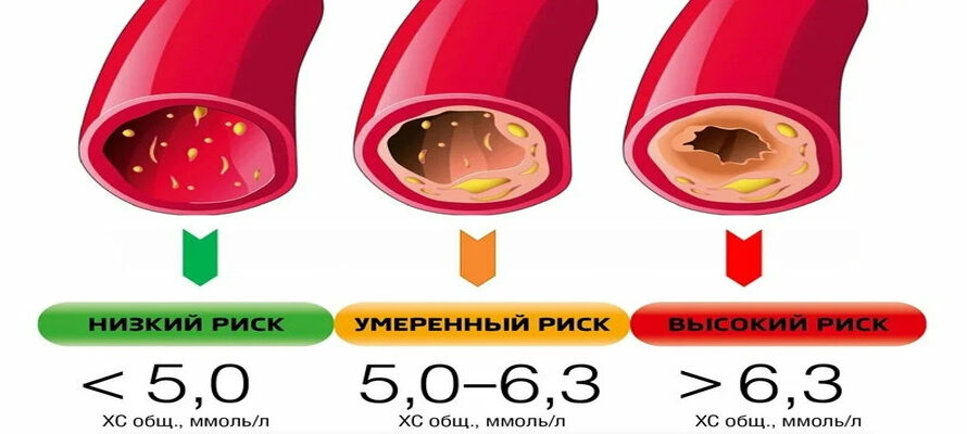 5 продуктов, которые помогают снизить уровень сахара в крови